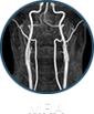 MRA - Colmar Imaging Center